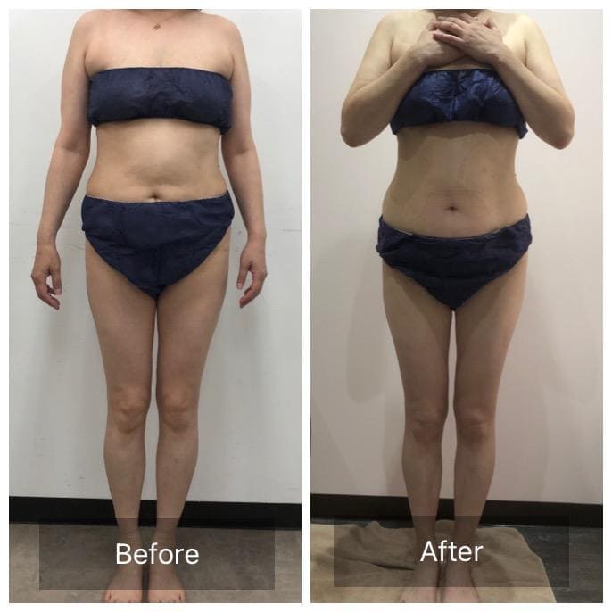 ビフォーアフター - 上半身集中コース